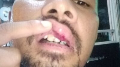 Wartawan Dikeroyok ABG Di Depok